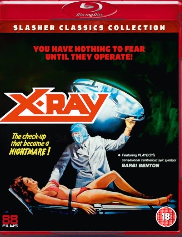 X-RAY